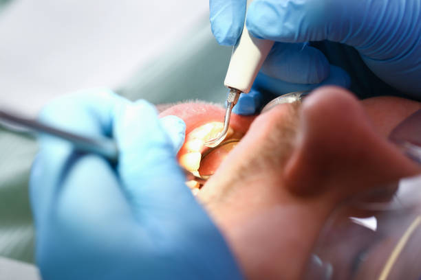 Best Knocked-Out Tooth Emergency  in Kimberly, AL