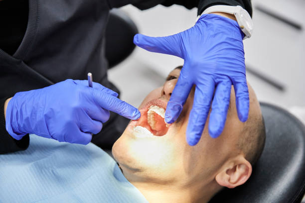 Best Dentist for Tooth Abscess  in Kimberly, AL