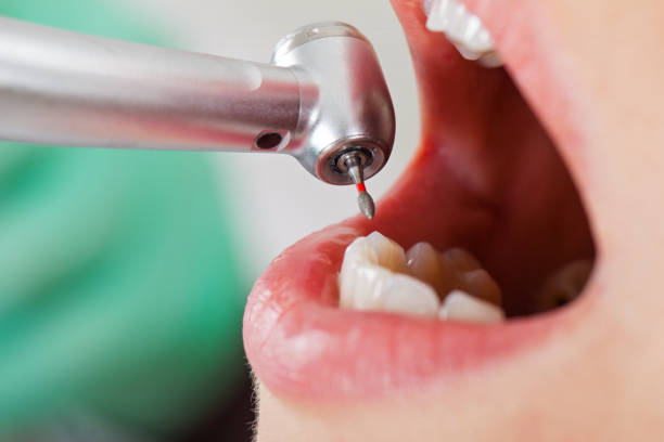 Best Knocked-Out Tooth Emergency  in Kimberly, AL